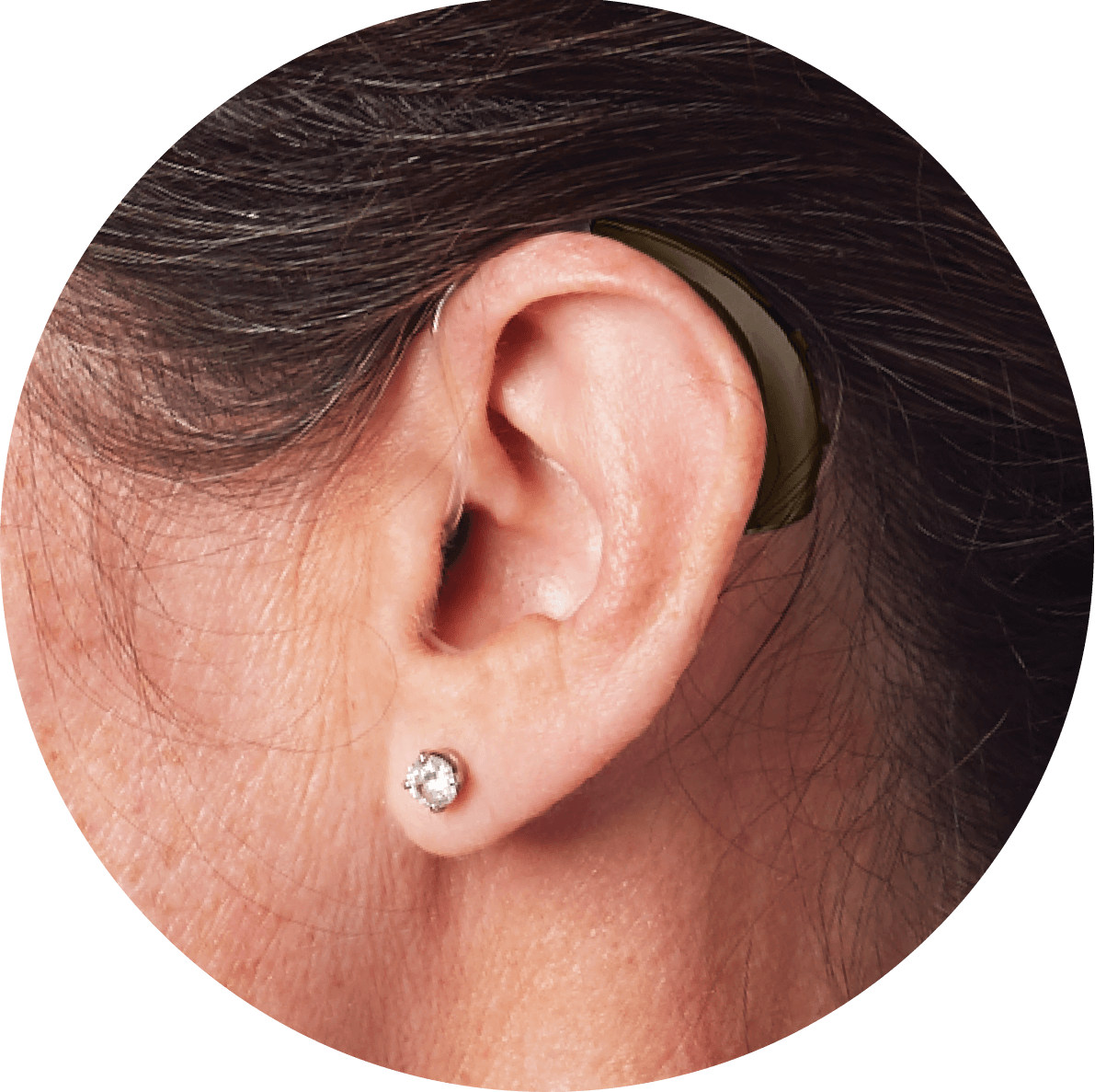 Woman with BTE Hearing Aid